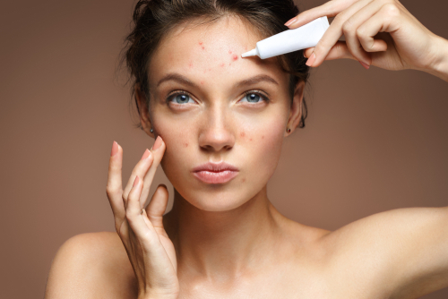 Segreti di Bellezza: Combatti l'Acne con Prodotti Innovativi