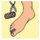 TUBOLARE CON GEL SU UN LATO 10CM DIGI-STRIP S - Farmacianuova.eu
