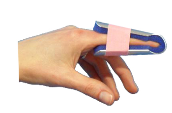 STECCA PER FRATTURA DITA A CAMPANA FARMASPLINT MISURA GRANDE PREFORMATA IN ALLUMINIO MODELLABILE CON IMBOTTITURA IN SPUGNA POLIURETANICA ANTIALLERGICA RADIOTRASPARENTE 15 CM - Farmacianuova.eu
