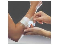 FILM ADESIVO IN POLIURETANO OPSITE FLEXIFIX IN ROTOLO TRASPARENTE IMPERMEABILE PER FISSAGGIO DI MEDICAZIONI E CATETERI LARGHEZZA 15 CM LUNGHEZZA 10 M 1 PEZZO - Farmacianuova.eu